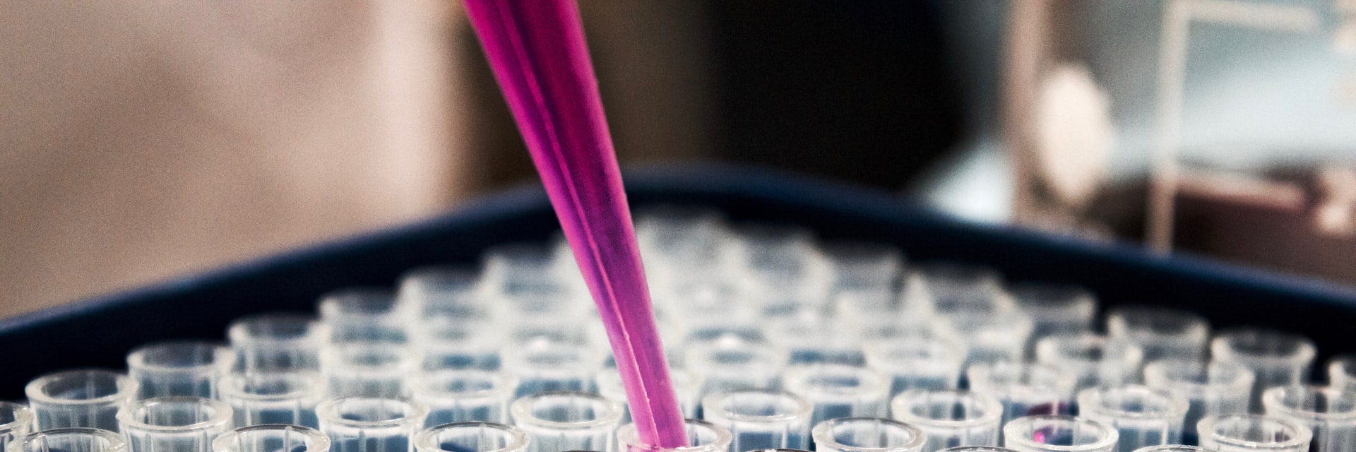 Labordiagnostik – Pipette mit Proben im Kinderwunsch-Labor